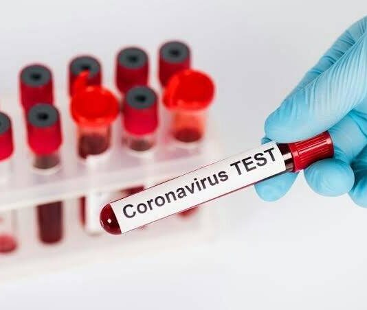 চট্টগ্রামে করোনা ভাইরাস: পাঁচ ল্যাবে শনাক্ত ২২২ জন