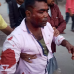 গুলিবিদ্ধসহ আহত ৩৫