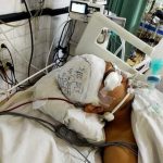 হাড় নেই, চাপ দেবেন না