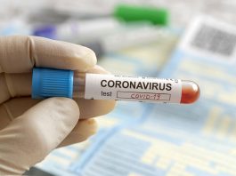 চট্টগ্রামে ১৯৪৪ জনের নমুনা পরীক্ষায় শনাক্ত ২৩৯