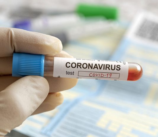 চট্টগ্রামে ১৯৪৪ জনের নমুনা পরীক্ষায় শনাক্ত ২৩৯