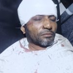 সন্ত্রাসী হামলায় সাবেক ইউপি সদস্য আহত, চমেক হাসপাতালে ভর্তি