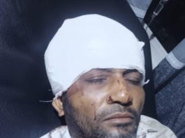 সন্ত্রাসী হামলায় সাবেক ইউপি সদস্য আহত, চমেক হাসপাতালে ভর্তি