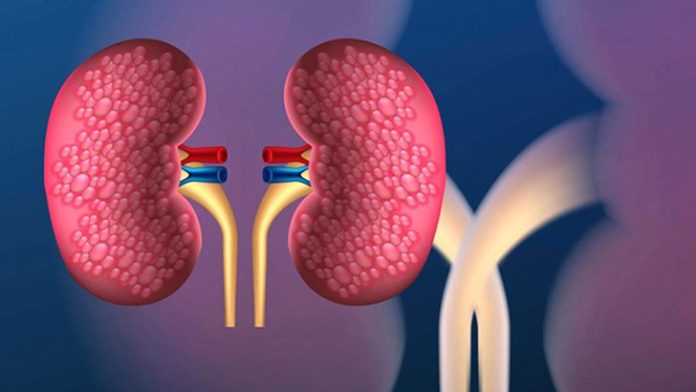 dhakatoday1638519863kidney3