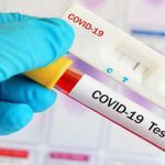 চট্টগ্রামে ২৪ ঘণ্টায় আরও ১০ জন করোনা আক্রান্ত