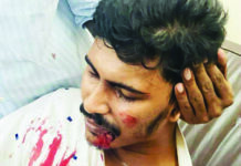 জিইসি কনভেনশন সেন্টারে কনসার্টে ‘জয় বাংলা’ স্লোগান, একজন গুলিবিদ্ধ