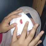 চলন্ত শাটল ট্রেনে পাথর নিক্ষেপ, আহত চবি শিক্ষার্থী
